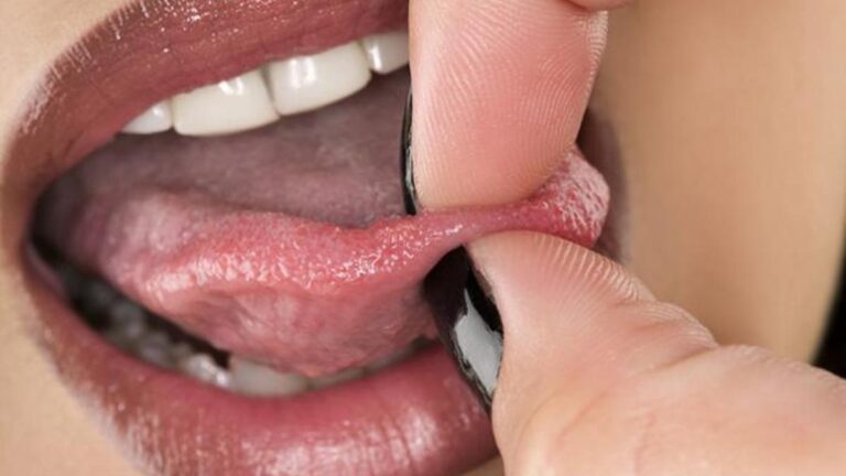 Diliniz genellikle duyarsızsa, bu sebep olabilir! Dil uyuşma dili nedir, neden? İntarpidin dilde belirtileri nelerdir, nasıl?